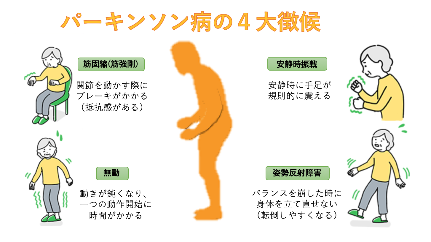 ーキンソン病の治療方法とは