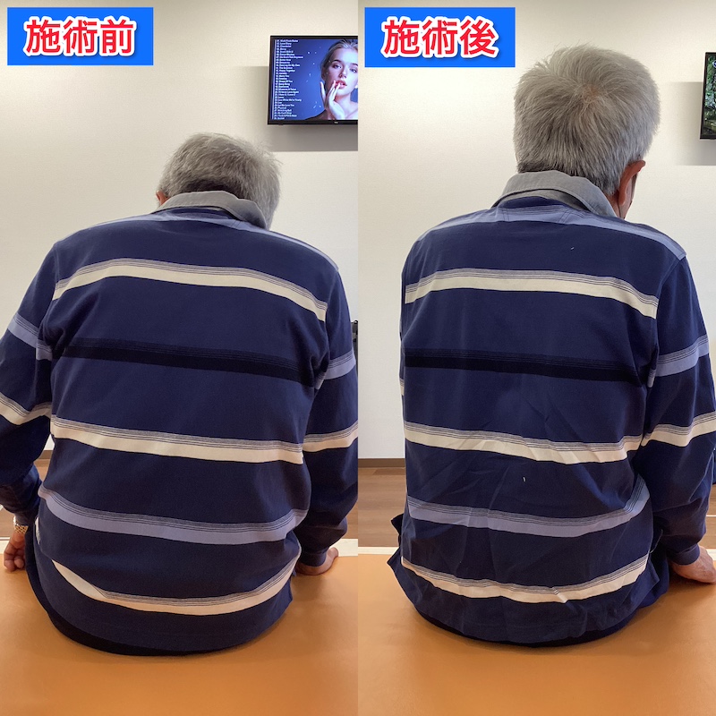 訪問・出張リハビリの治療方法とは