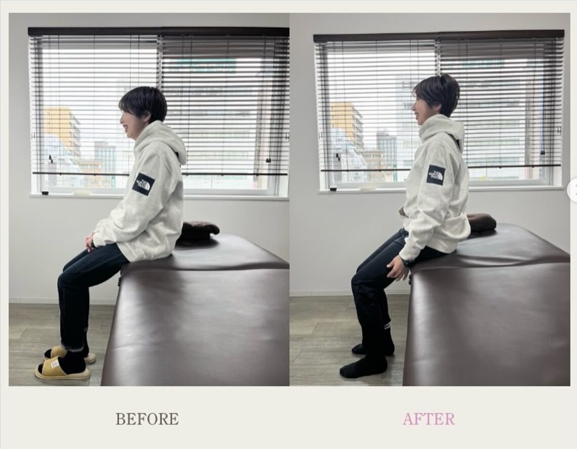 Before After ストレッチによる姿勢変化