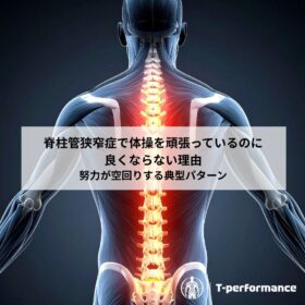 脊柱管狭窄症のリハビリについて｜静岡のリハビリ・コンディショニングラボ　T-performance