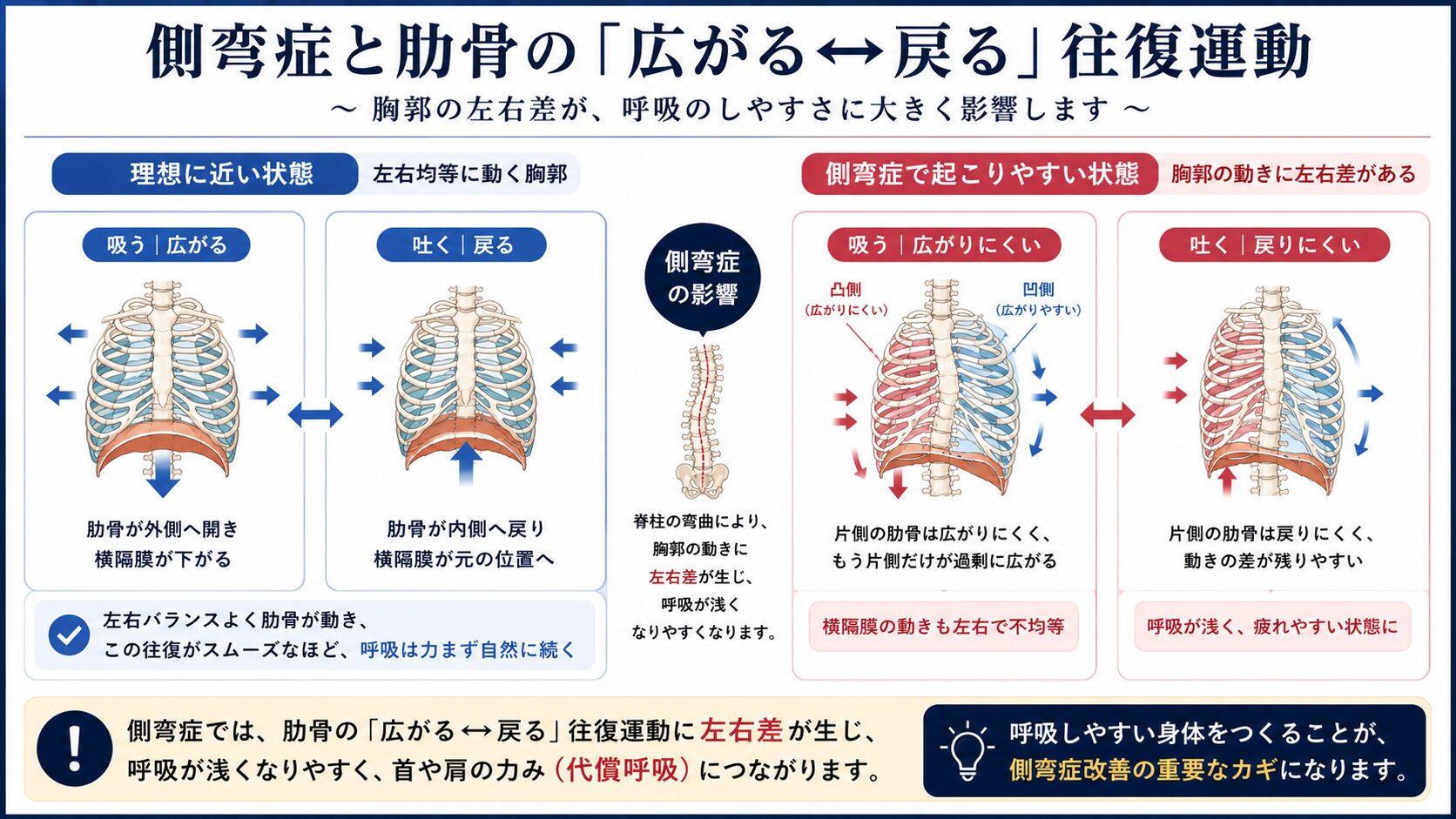 側弯症 呼吸 肋骨 広がる 戻る 往復運動