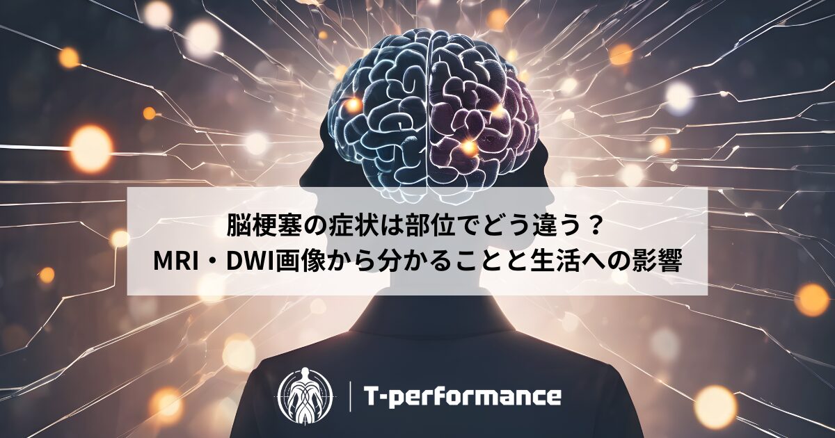 脳梗塞リハビリと画像診断について|静岡のリハビリ・コンディショニングラボ