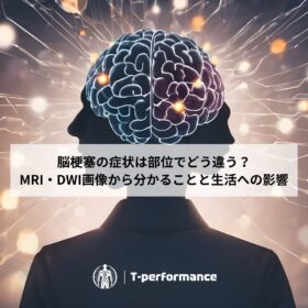 脳梗塞リハビリと画像診断について｜静岡のリハビリ・コンディショニングラボ