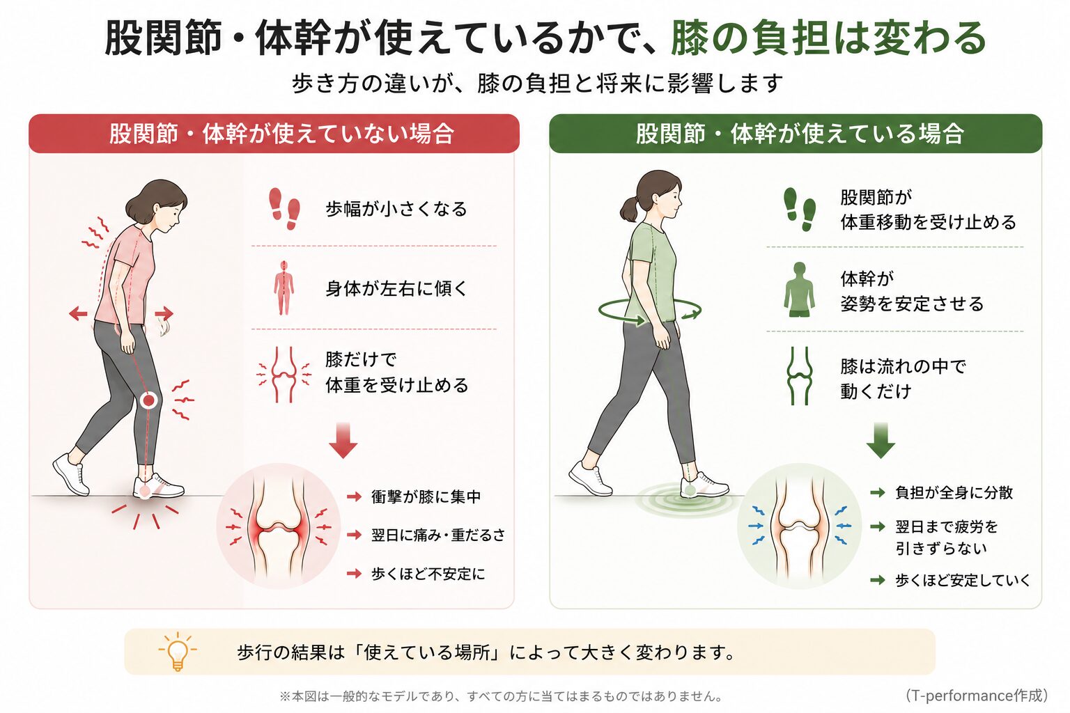 股関節・体幹が使えている場合と使えていない場合で膝への負担がどう変わるかを比較した歩行姿勢の図解
