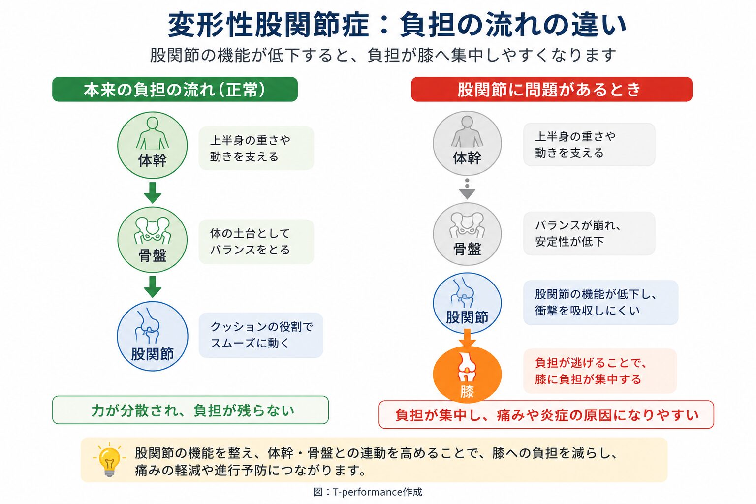変形性股関節症 股関節から膝への負担の流れを比較したインフォグラフィック
