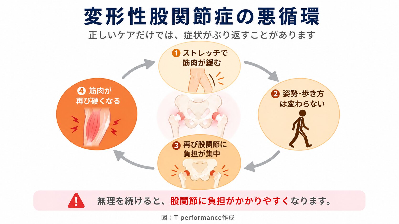 変形性股関節症 ストレッチの効果が続かない悪循環インフォグラフィック