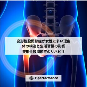 変形性股関節症が女性に多い理由｜体の構造と生活習慣の影響