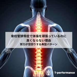 脊柱管狭窄症のリハビリについて｜静岡のリハビリ・コンディショニングラボ　T-performance